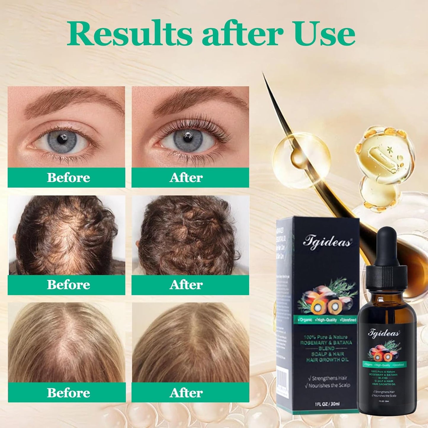 Rosemary Batana Oil - Organic Hair Growth - for Scalp & Hair Strengthening - All Hair Types Treatment Oil - Eyebrow & Eyelash Nourishing - 2 Packs