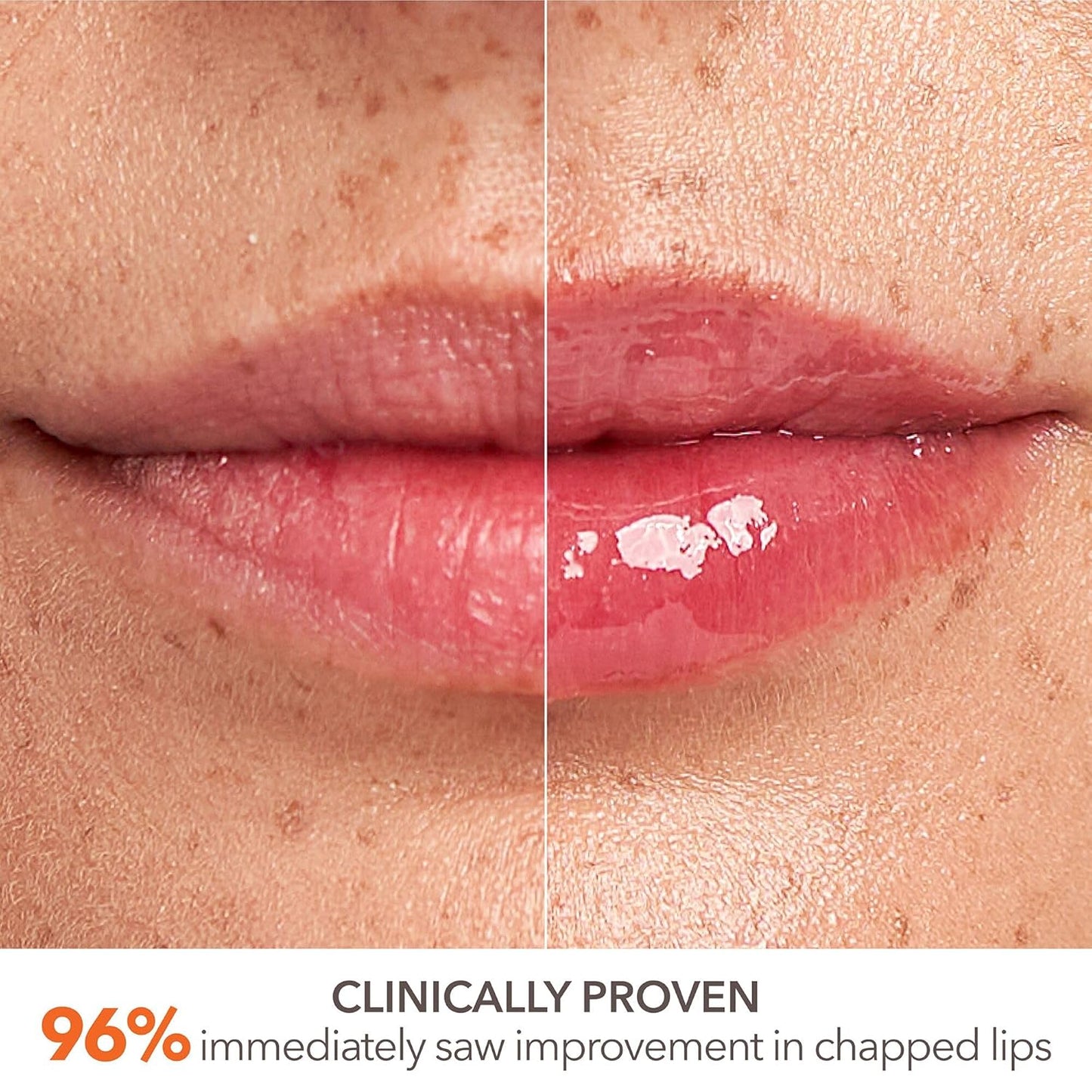 Dr Dennis Gross DermInfusions Plump + Repair Lip Treatment | Visibly Plumps & Defines Lips While Repairing The Moisture Barrier | 4ml