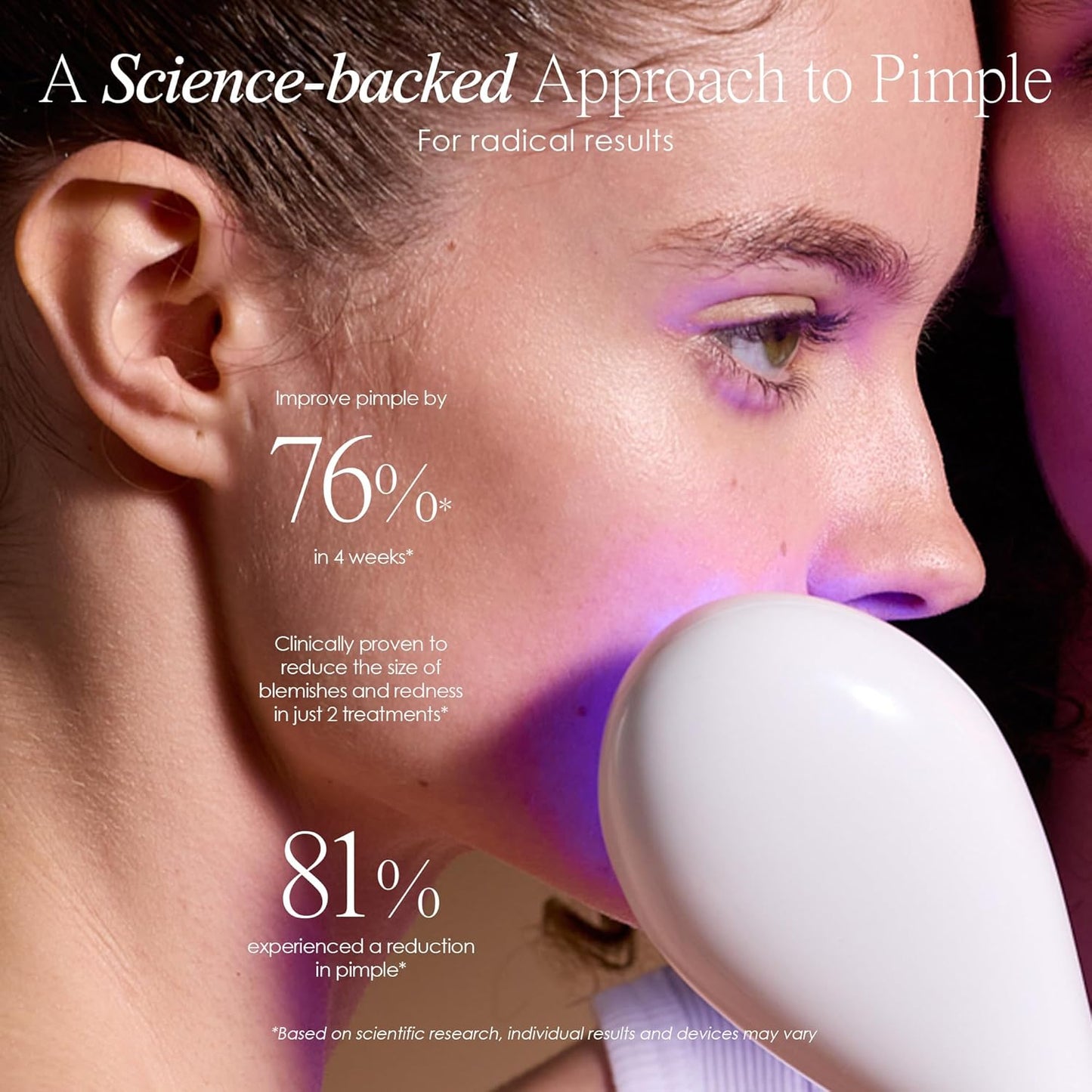 LumaGlow Blue LED Light Therapy by Project E Beauty | Anti Acne | Pimple & Blemish Solution | Skincare Routine for Oily Skin | Handheld Device for Spa & Home Use (Blue Light)