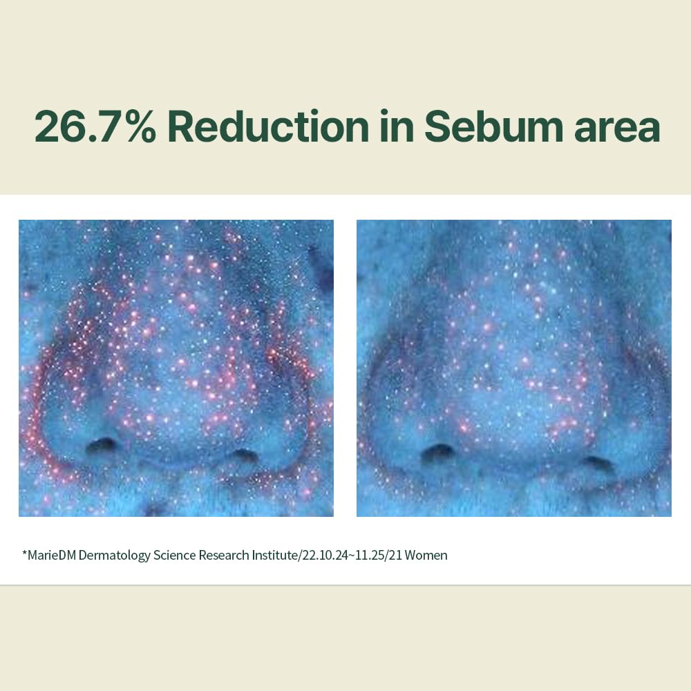 Pyunkang Yul Calming Moisture Serum for Strong Daily Moisturizing Power, Skin Revival & Soothing Care with Centella Asiatica, Tea Tree, 5 Hyaluronic Acids, Ceramide |