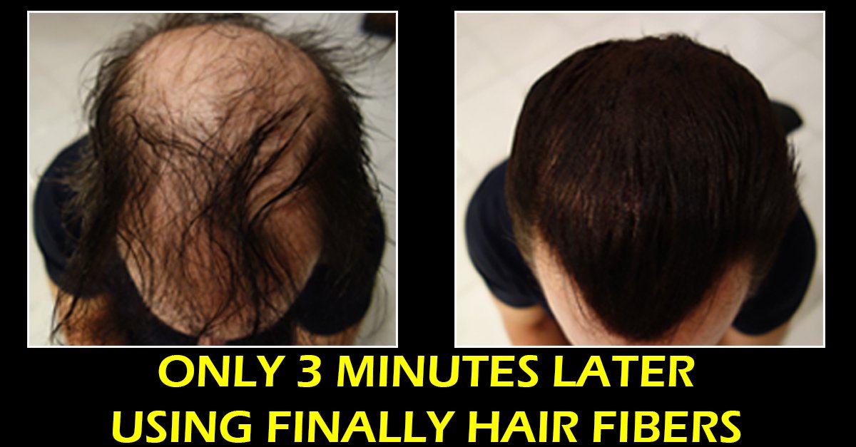 Finally Hair Sprayer Atomizer Empty Bottle For One Handed Operation Easy To Use - for use with all brands of fibers (for use with refill bags - fibers not included)