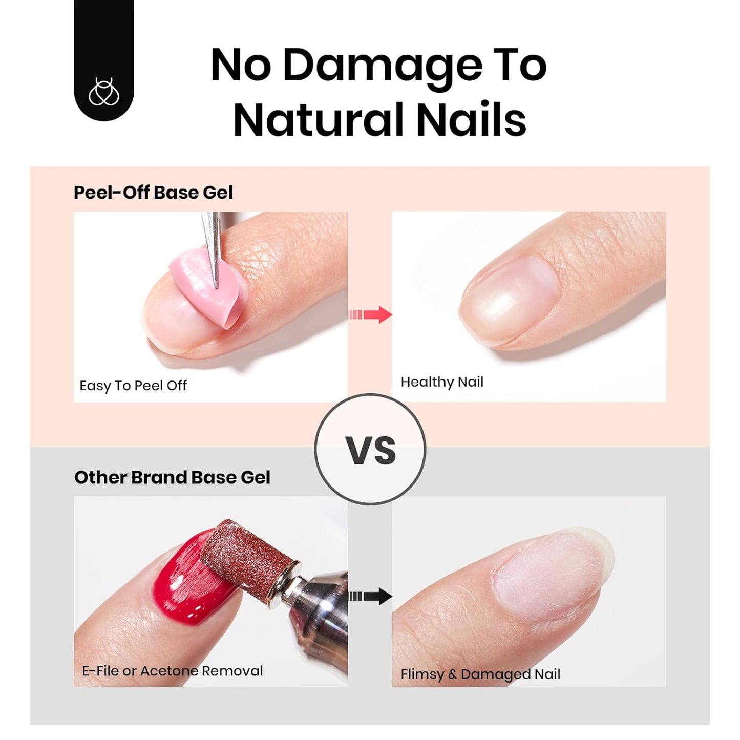 Beetles Peel‑Off Gel Base Coat 15 ml – Easy Removal Base Gel Nail Polish UV/LED Soak‑Off, Damage‑Free Low‑Odor 7‑10 Day Long‑Lasting, Beginner & Salon Friendly