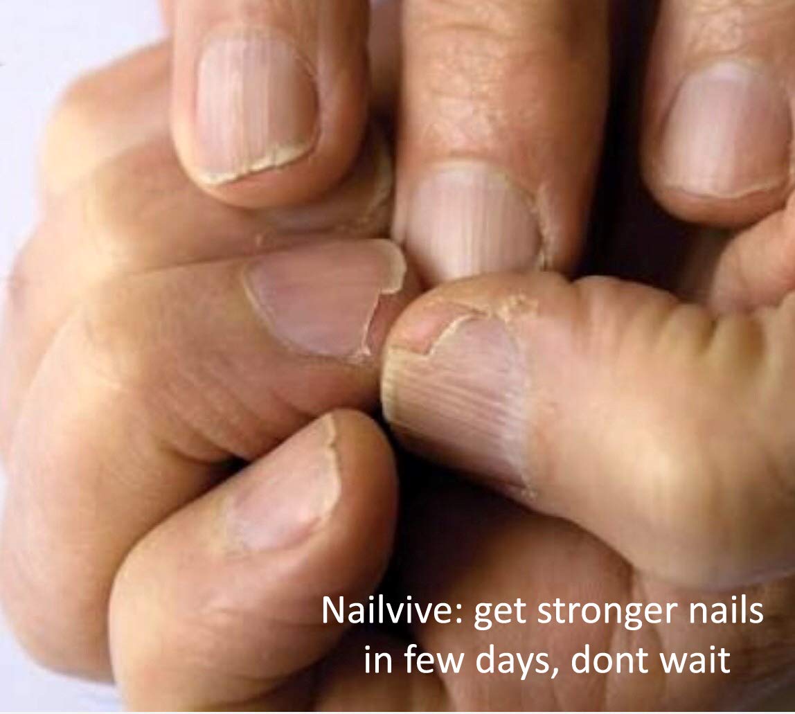 NAILVIVE Nail Serum Powerful Magic-like Silk Proteins Proven Natural Formula Strengthening Hardening nails Instantly Prevents Splits Chips Peels Cracks on Your Nails (PEN APPLICATOR)