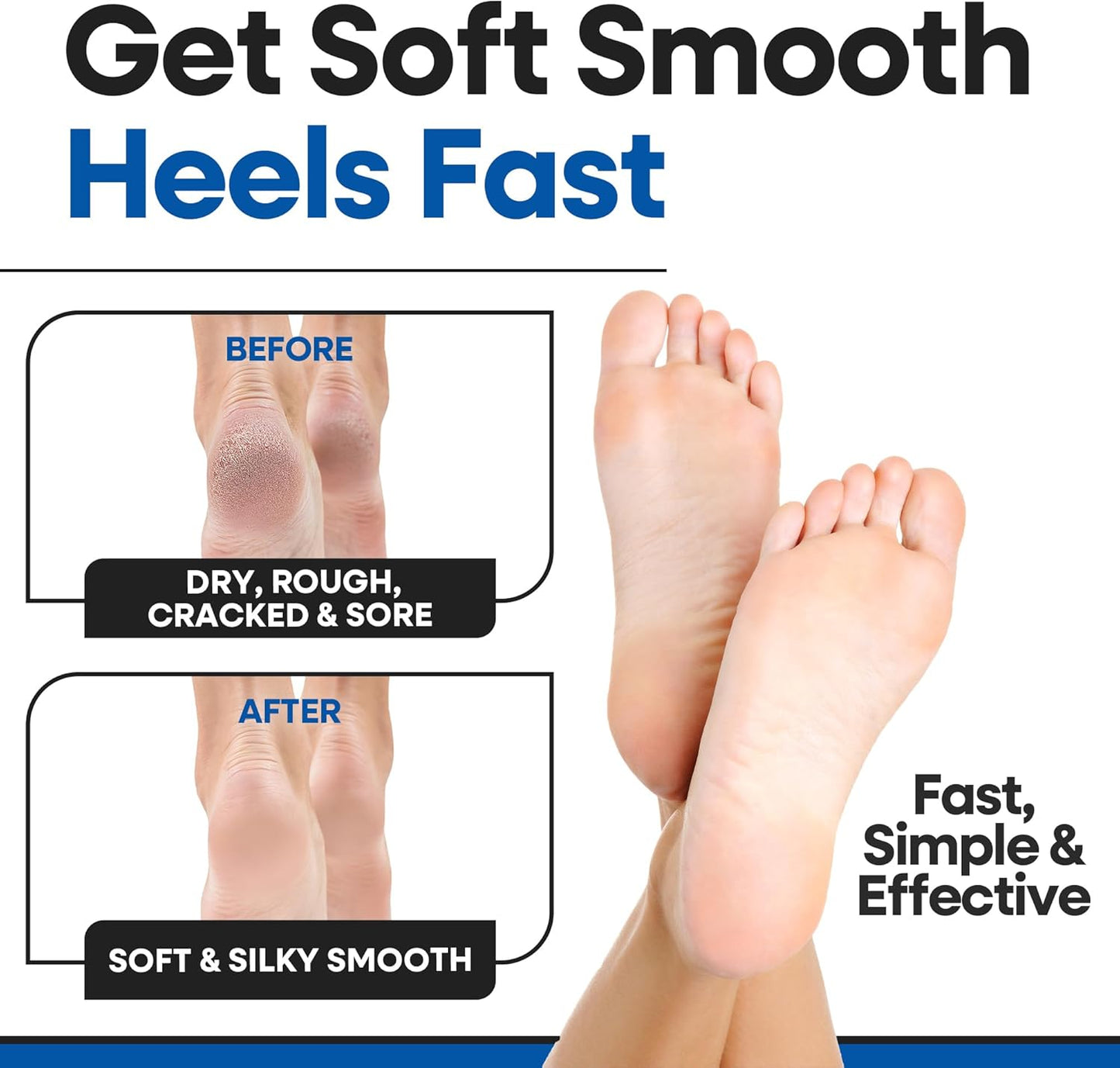 Moisturizing Socks for Women & Men | Aloe Vera Cracked Heel Treatment | Foot Callus Remover | Aloe Socks for Cracked Heels & Dry Cracked Feet | Lotion Infused Gel Heel Socks (Fits Most - 2 Pairs)