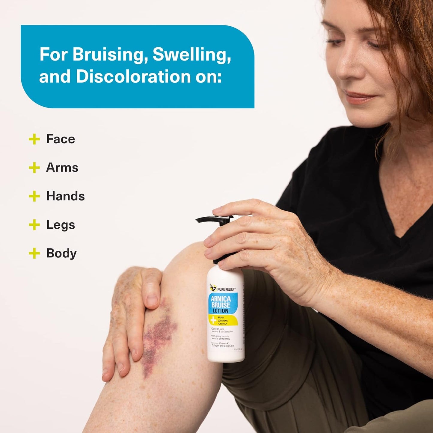 Arnica Bruise Relief Lotion for Bruising, Swelling, & Discoloration On Skin, Natural Skin Care Arnica Bruise Homeopathic Topical Bruise Cream W/Aloe Vera & Collagen, 4 Fl Oz (Pack of 2)