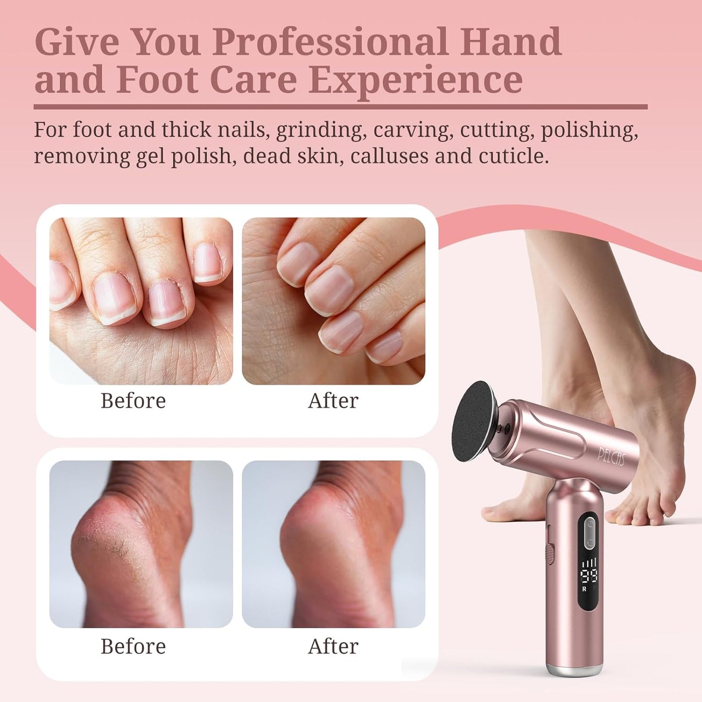 PELCAS Electric Foot Callus Remover with LED Screen, 2 in 1 Manicure & Pedicure Kit, Upgraded Electric Foot File for Women & Men, Cordless Feet Filer for Foot Callus, Thick Nails, Finger Nails Pink