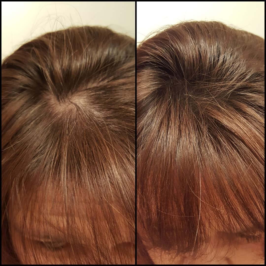 Caboki Hair Building Fiber. (30G, 90-Day Supply). Auburn