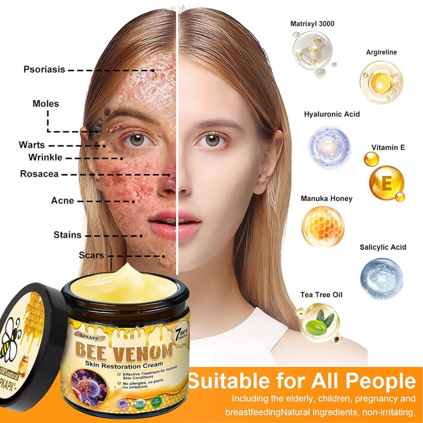 Bee Venom Skin Restoration Cream, Bee Venom Skin Treatment Cream, Professional Bee Venom Comprehensive cream - Anti-Wrinkle Moisturizing for All skin Typess (3)