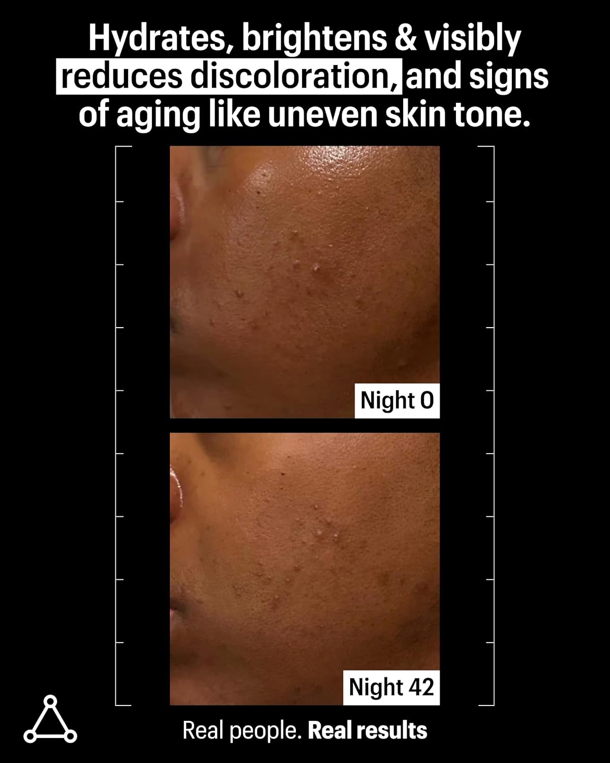 Allies of Skin Mandelic Pigmentation Corrector Night Serum | Gentle Acne Face Serum with Bakuchiol, Niacinamide & Salicylic Acid | Anti-Aging Formula to Reduce Pores and Even Skin Tone (1 oz)