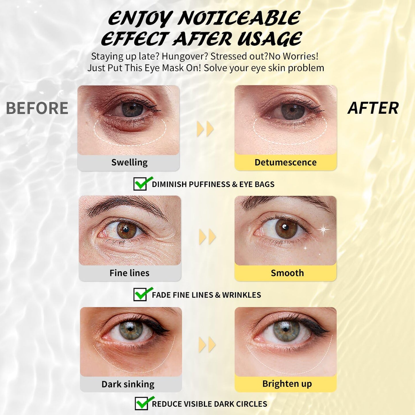Under Eye Patches (30 Pairs), Hyaluronic Acid Eye Masks for Dark Circles Puffy Eyes Undereye Bags, Collagen Eye Patches for Wrinkles and Hydrate, Skin Care Gift for Her