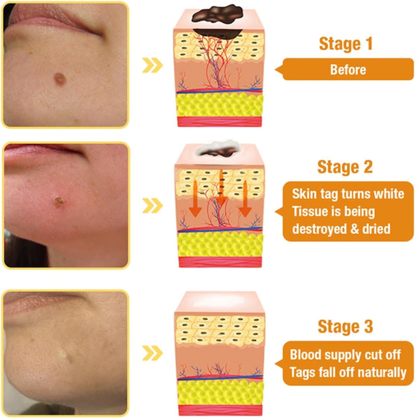 Bee Venom Comprehensive Cream, 2025 New Bee Venom Skin Treatment Cream, Firms and rejuvenates the skin, Natural Serum Suitable for All Skin Types (3)