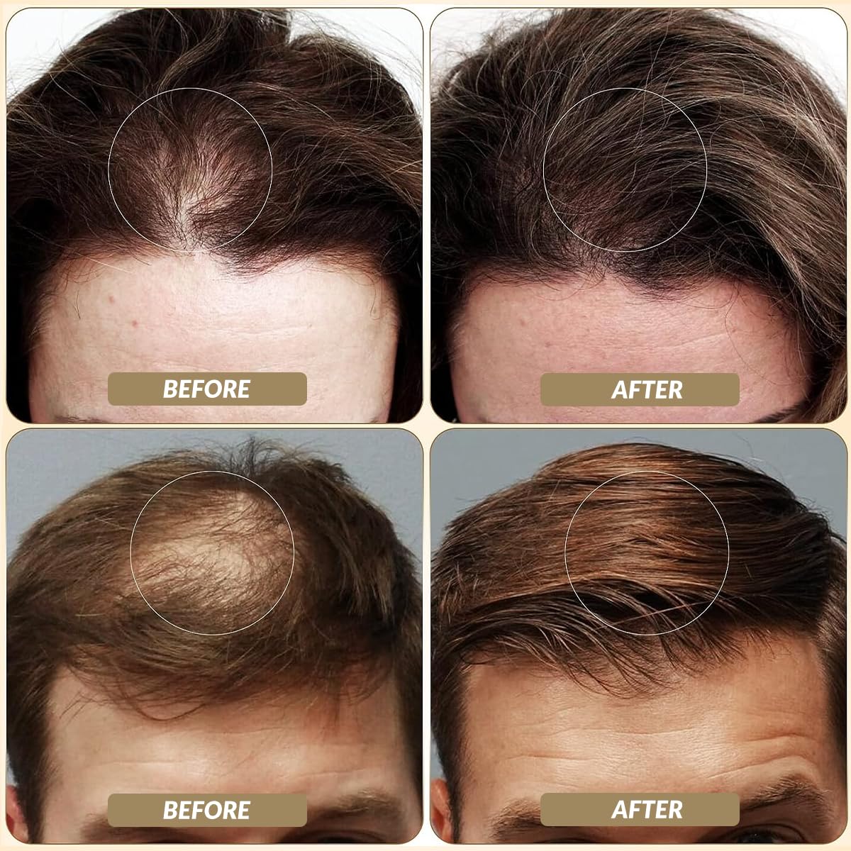 SOVONCARE Hair Fibers for Thinning Hair White, Hair Building Fibers for Bald Spots Undetectable & Natural, Conceals Hair Loss Fill In Fine, Hair Powder Hair Thicker Instantly for Women & Men 28g