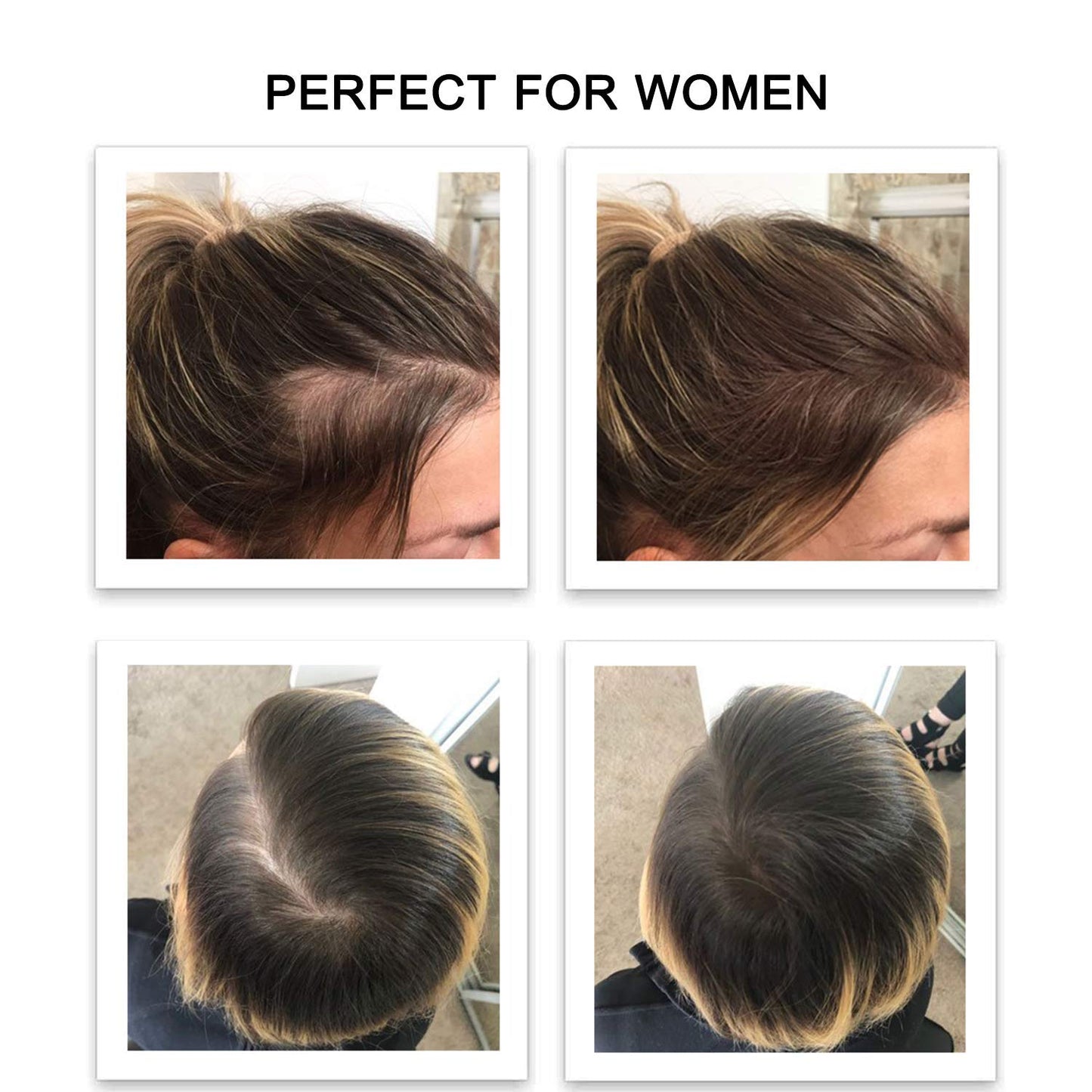 FEBRON Hair Fibers For Thinning Hair GRAY For Women & Men Hair Loss Concealer Hair Powder Volumizing Based 100% Undetectable & Natural - Bald Spots Filler (30 Gram, Gray)