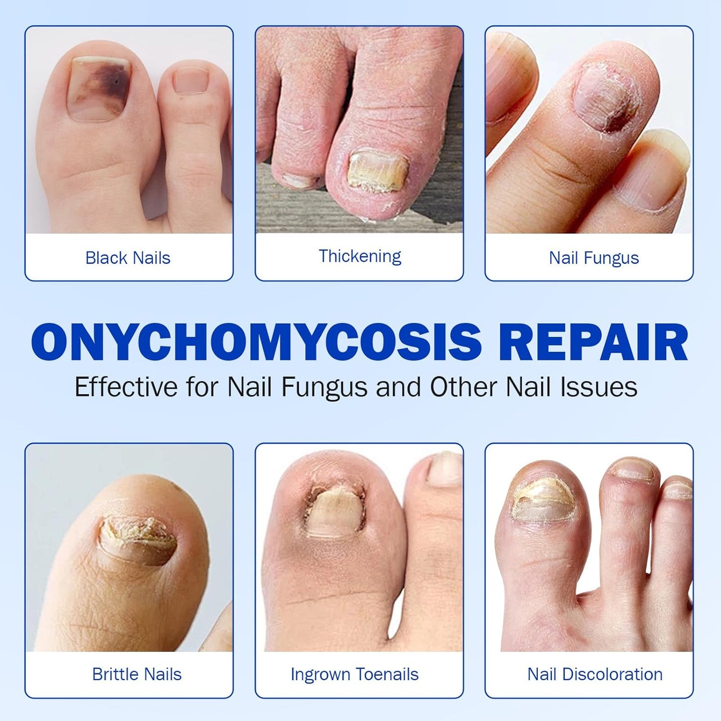 21 PCS Nail Patches ，Toenail Treatment Patch Extra Strength 8-Hour ，Nail Repair Patches,Nail Repair for Restores Damaged Nails and Appearance of Discolored，Overnight Renewal for Men and Women