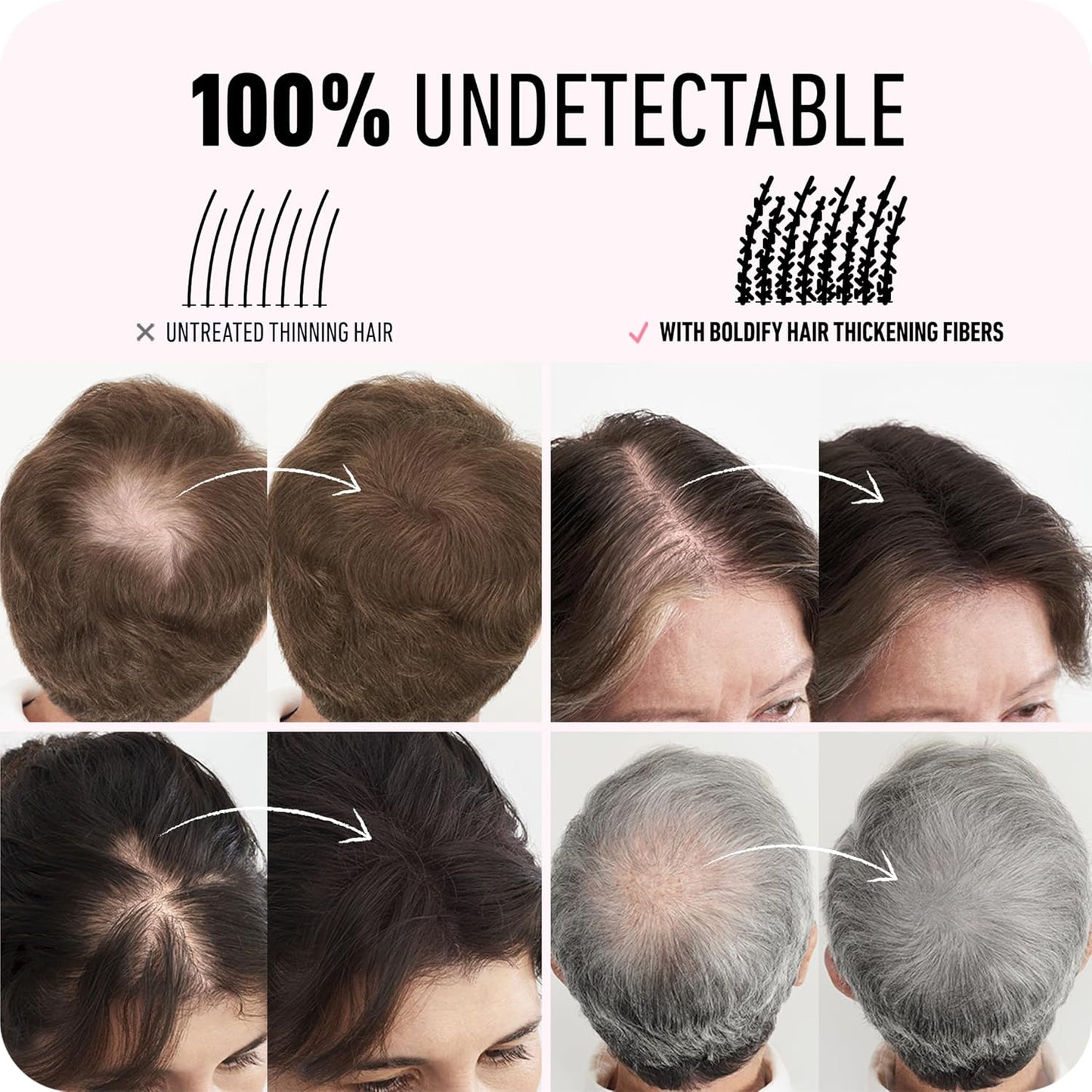 BOLDIFY Hair Fibers (28g) - Fill In Thinning and Fine Hair for an Instantly Fuller, Thicker Look - 14 Shades for Women & Men - Auburn