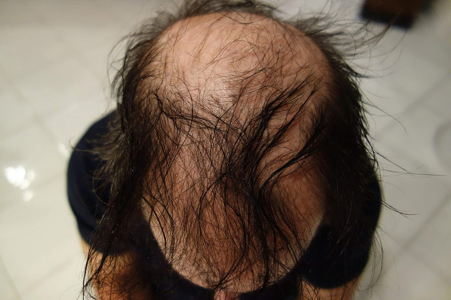 Hair Building Fibers 200 Grams 7 Oz. With Bottle By Finally Hair 50g*4 (Black)