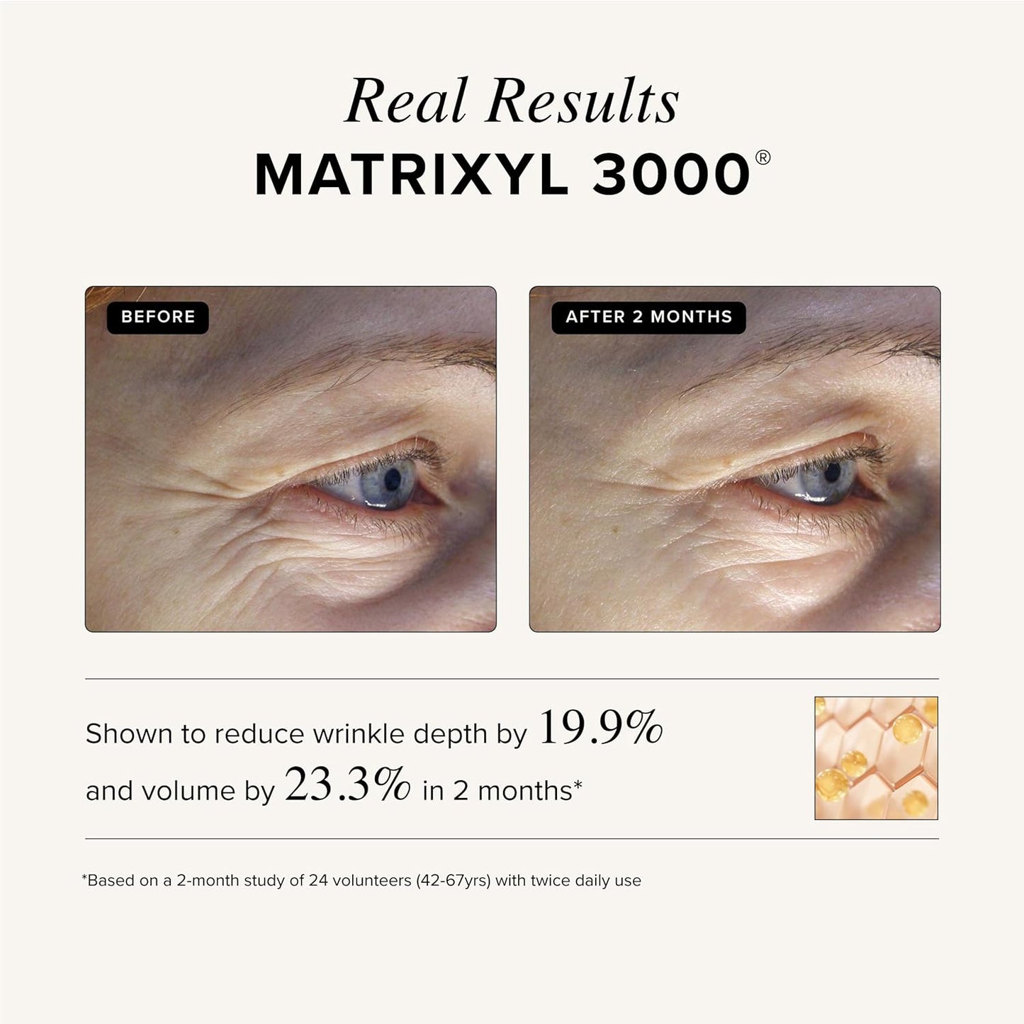 Asterwood Triple Repair Matrixyl 3000 + Argireline + Hyaluronic Acid + Vitamin C Serum for Face - Anti-Aging, Collagen Boosting, Hydrating - Fragrance-Free - 4 Fl Oz