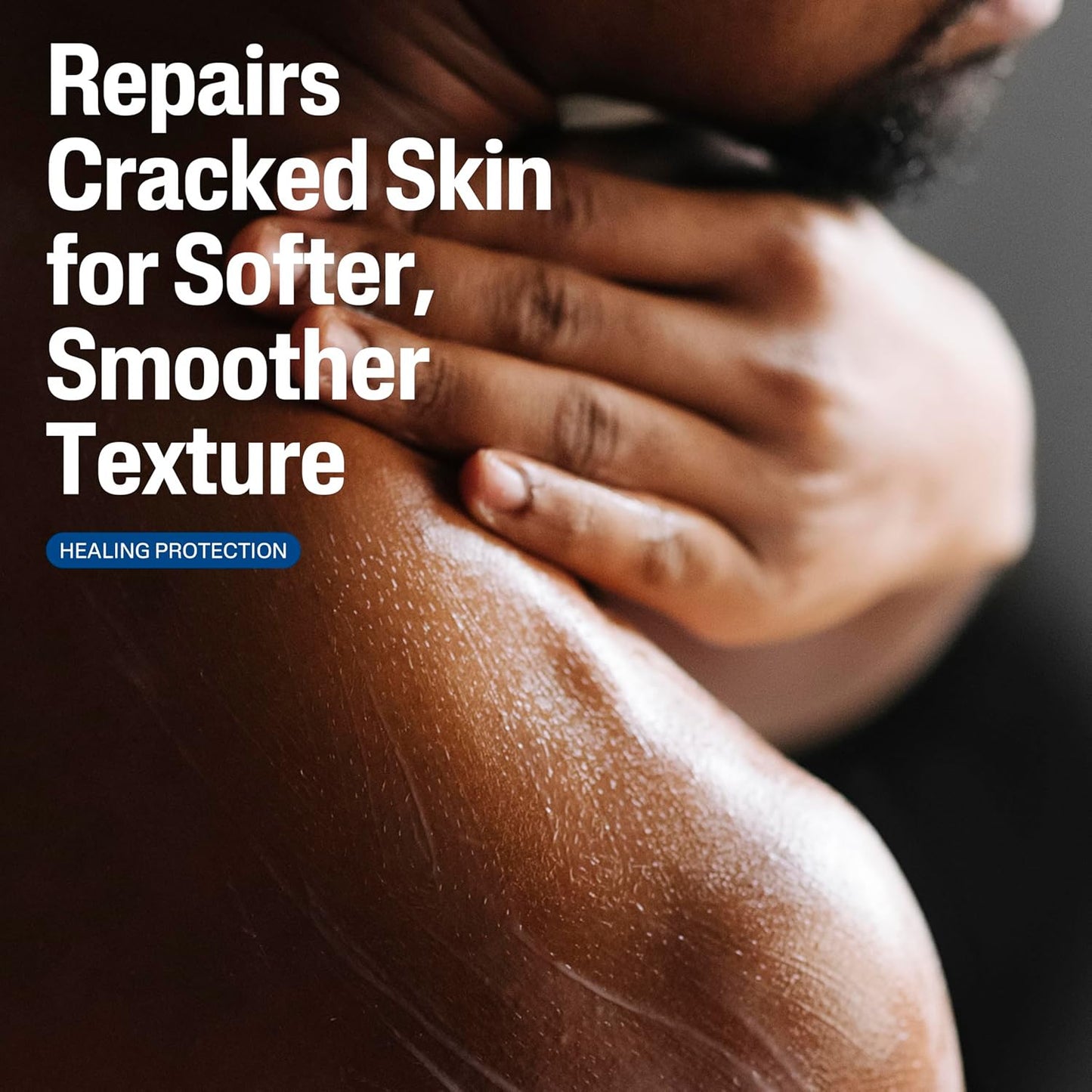 Cetaphil Cracked Skin Repair Lotion, 16 oz, For Very Rough & Cracked, Sensitive Skin, 24 Hour Hydration, Protects & Hydrates Cracked Skin, Hypoallergenic, Fragrance Free