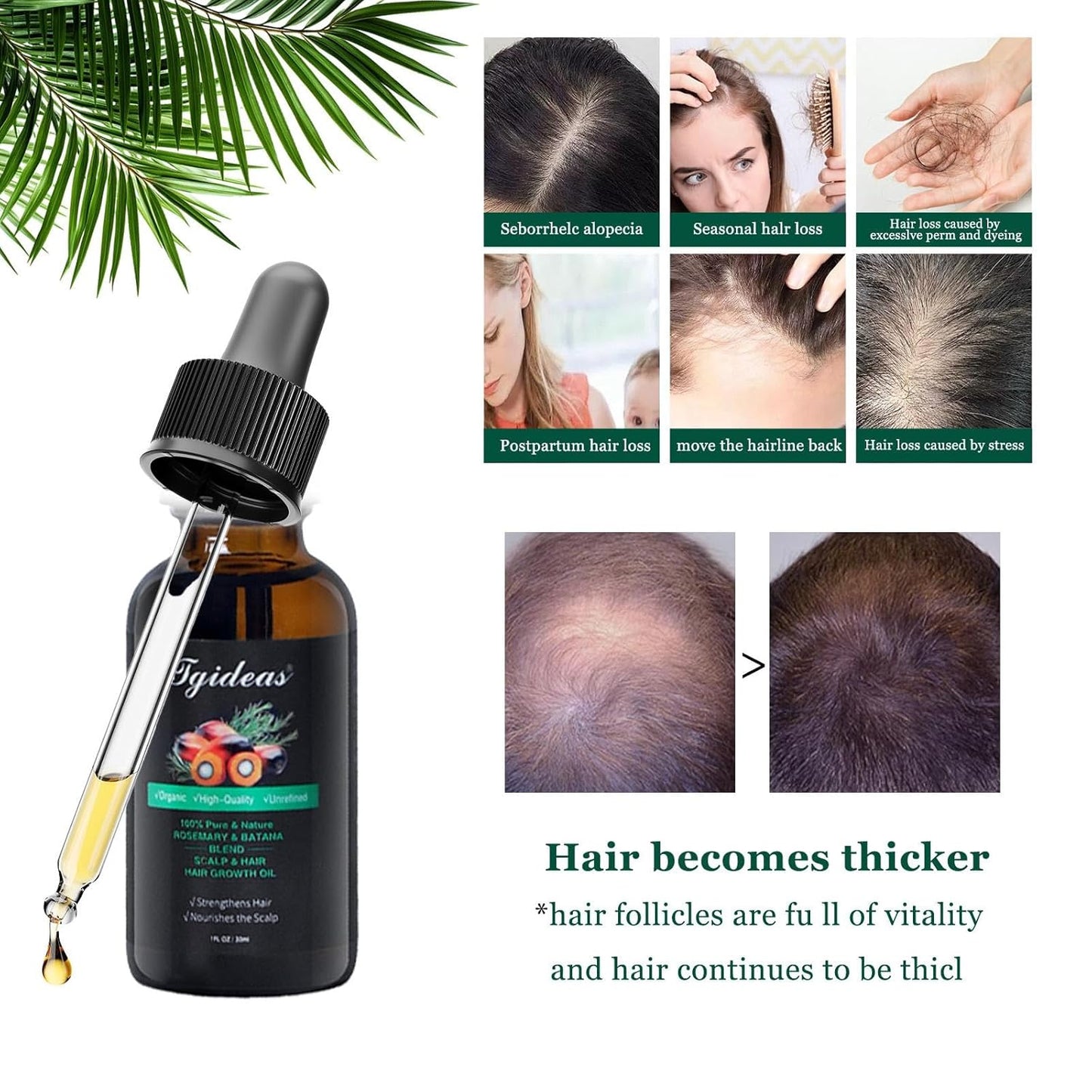 Rosemary Batana Oil - Organic Hair Growth -for Scalp & Hair Strengthening - All Hair Types Treatment Oil - Eyebrow & Eyelash Nourishing