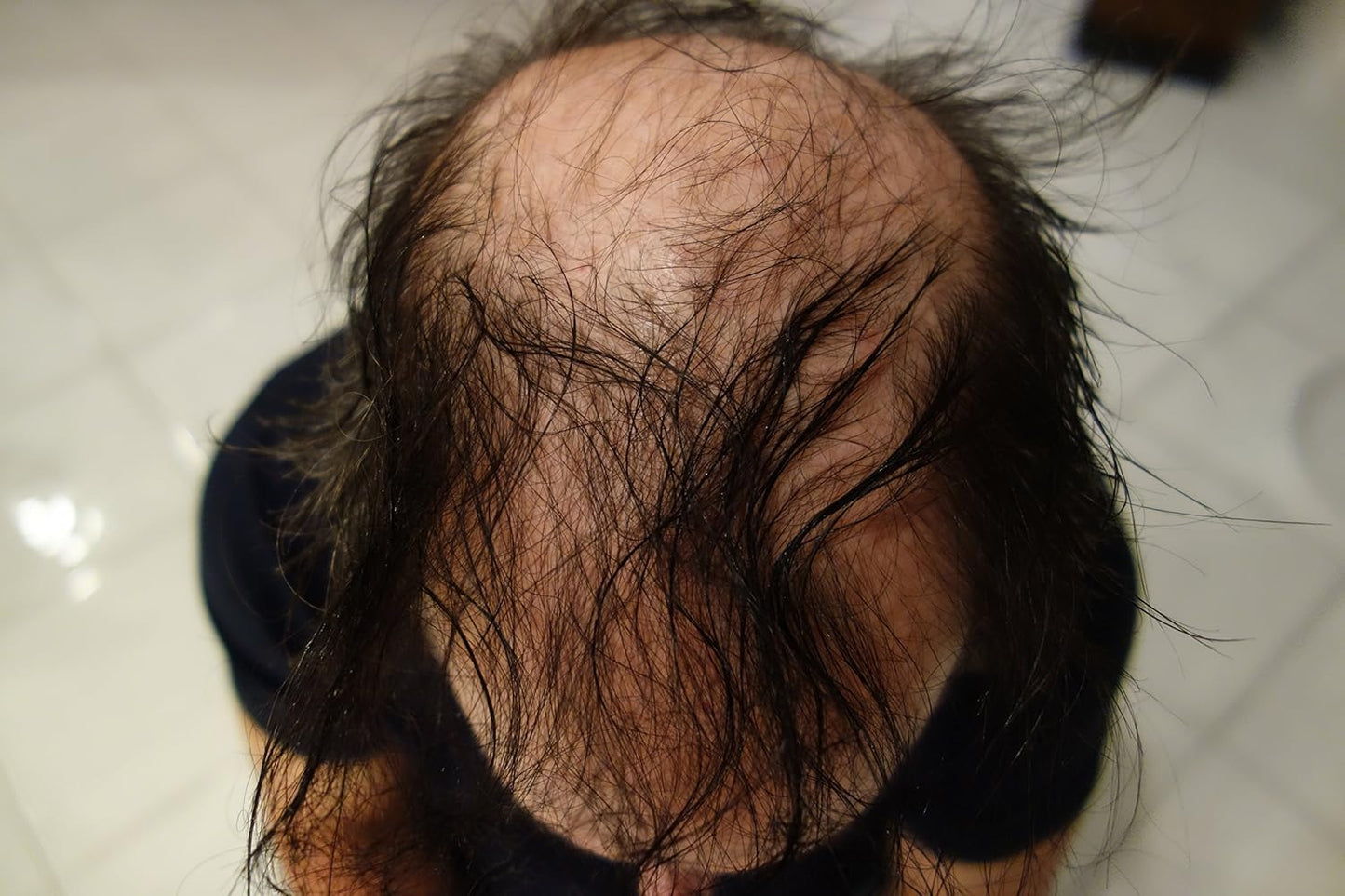 New Hair Building Fibers 100+14=114 Grams. Highest Grade Refill That You Can Use for Your Bottles From Competitors Like Toppik, Xfusion, Nor1 (Pure White)