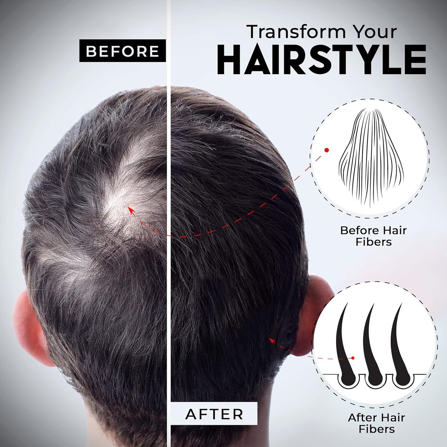 ELEVATE Hair Fibers to Instantly Thicken & Completely Conceal Thinning Balding Areas Loss in 30 Seconds for Men & Women (DARK BROWN) 28g Size - 100% Natural & Undetectable Keratin Fibers